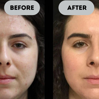 Celluma™ - Anti-Aging Booster Pro